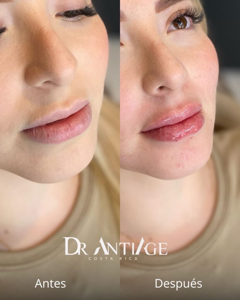 Labios