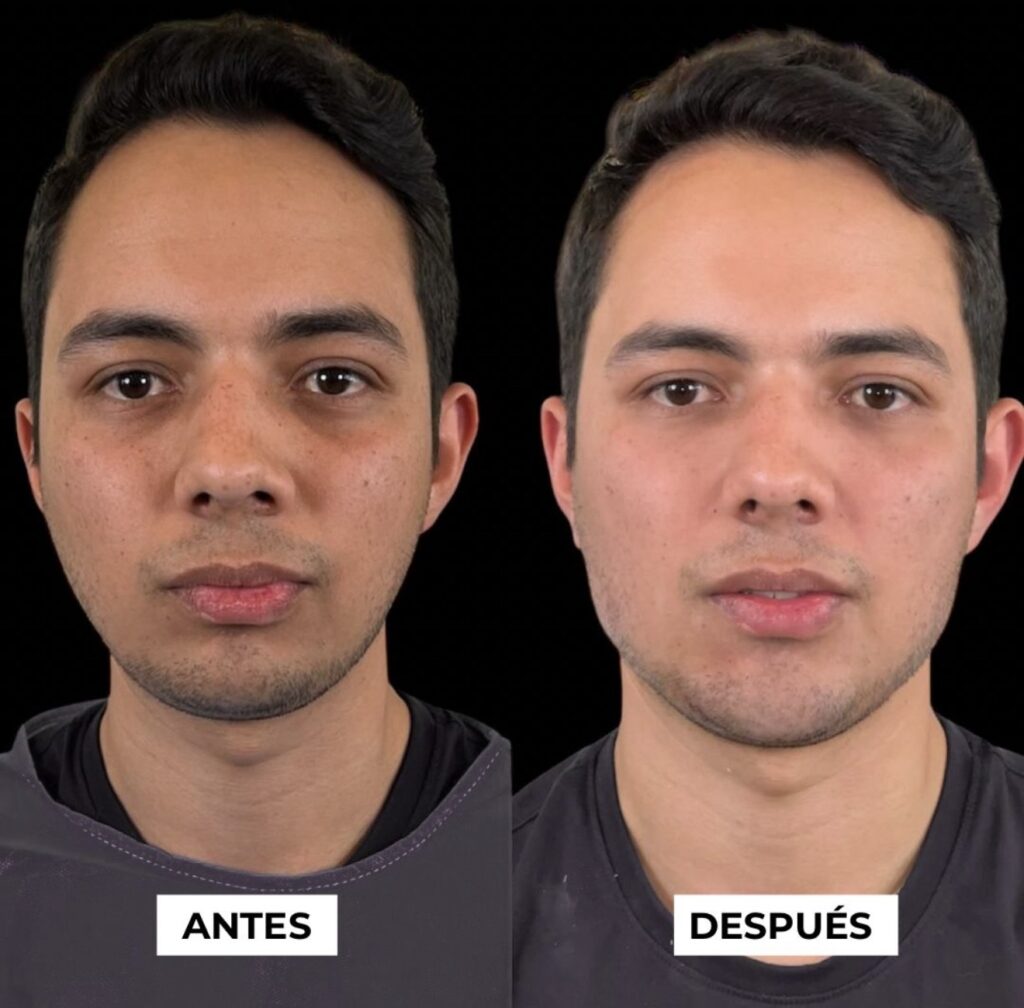 Armonización Facial Estética Costa Rica